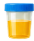 Urine Tests